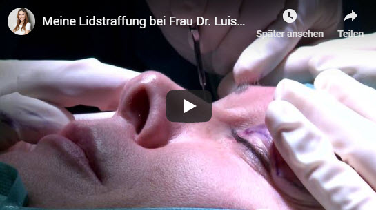 Video zur Lidstraffung mit Dr. med. Luise Berger